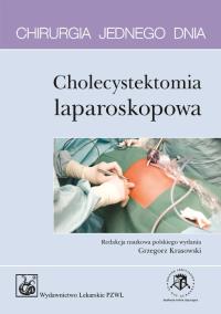 Chirurgia jednego dnia Cholecystektomia laparoskopowa. Wydawca: PZWL. Dobreksiazki.pl Opakowanie Chirurgia jednego dnia Cholecystektomia laparoskopowa