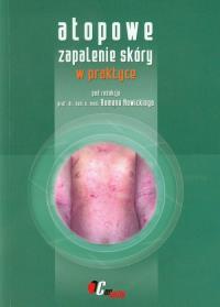 Atopowe zapalenie skóry w praktyce. Wydawca: Cornetis. Dobreksiazki.pl Opakowanie Atopowe zapalenie skóry w praktyce