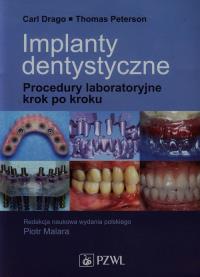Implanty dentystyczne. Procedury laboratoryjne. Autor: Drago Carl, Peterson Thomas. Dobreksiazki.pl Okładka książki Implanty dentystyczne. Procedury laboratoryjne