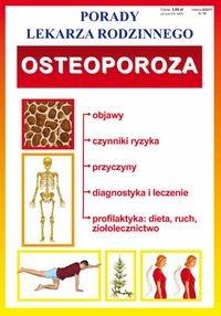 Porady lek. rodzinnego. Osteoporoza. Autor: praca zbiorowa. Dobreksiazki.pl Okładka książki Porady lek. rodzinnego. Osteoporoza