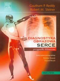 Diagnostyka obrazowa serca przypadki kliniczne. Autor: Reddy Gautham P., Steiner Robert M.. Dobreksiazki.pl Okładka książki Diagnostyka obrazowa serca przypadki kliniczne