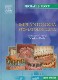 Implantologia stomatologiczna. Autor: Block Michael S.. Dobreksiazki.pl Okładka książki Implantologia stomatologiczna