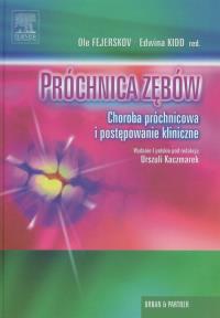 Próchnica zębów. Wydawca: Urban & Partner. Dobreksiazki.pl Opakowanie Próchnica zębów