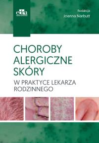 Choroby alergiczne skóry w praktyce lekarza rodzinnego. Wydawca: Edra Urban & Partner. Dobreksiazki.pl Opakowanie Choroby alergiczne skóry w praktyce lekarza rodzinnego