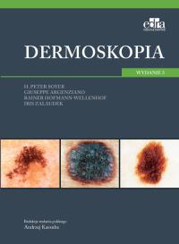 Dermoskopia. Autor: Soyer H.P., Argenziano G., Hofmann-Wellenhof R., Zalaudek I.. Dobreksiazki.pl Okładka książki Dermoskopia