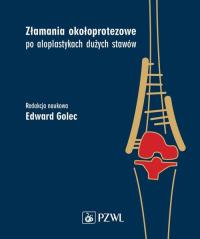 Złamania okołoprotezowe po aloplastykach dużych stawów. Autor: Golec Edward. Dobreksiazki.pl Okładka książki Złamania okołoprotezowe po aloplastykach dużych stawów