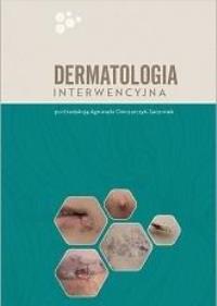Dermatologia interwencyjna. Autor: red. Agnieszka Owczarczyk-Saczonek. Dobreksiazki.pl Okładka książki Dermatologia interwencyjna