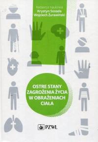 Ostre stany zagrożenia życia w obrażeniach ciała. Autor: Krystyn Sosada, Wojciech Żurawiński. Dobreksiazki.pl Okładka książki Ostre stany zagrożenia życia w obrażeniach ciała
