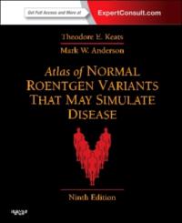 Okładka książki Atlas of Normal Roentgen Variants That May Simulate Disease