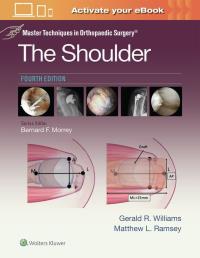 Okładka książki Master Techniques in Orthopaedic Surgery: The Shoulder: Print + eBook with Multimedia
