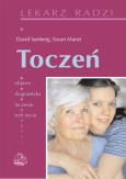 Toczeń. Autor: David Isenberg, Susan Manzi. Dobreksiazki.pl Okładka książki Toczeń