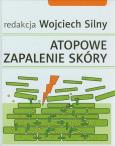 Okładka książki Atopowe zapalenie skóry