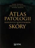 Okładka książki Atlas patologii złośliwych nowotworów skóry