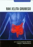 Rak jelita grubego. Autor: Andrzej Deptała, Marek Z. Wojtukiewicz. Dobreksiazki.pl Okładka książki Rak jelita grubego