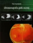 Ultrasonografia gałki ocznej. Autor: Fryczkowski Piotr. Dobreksiazki.pl Okładka książki Ultrasonografia gałki ocznej
