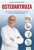 Osteoartroza. Usuń ból stawów dzięki delikatnym ćwiczeniom, diecie oraz medycynie naturalnej. Autor: Musa Citak. Dobreksiazki.pl Okładka książki Osteoartroza. Usuń ból stawów dzięki delikatnym ćwiczeniom, diecie oraz medycynie naturalnej