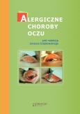 Alergiczne choroby oczu. Autor: Bogacka Ewa, Czajkowski Janusz, Małolepszy Józef. Dobreksiazki.pl Okładka książki Alergiczne choroby oczu