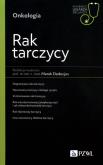 Okładka książki Rak tarczycy