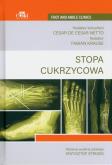 Opakowanie Stopa cukrzycowa