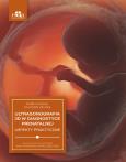 Okładka książki Ultrasonografia 3D w diagnostyce prenatalnej