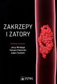 Okładka książki Zakrzepy i zatory